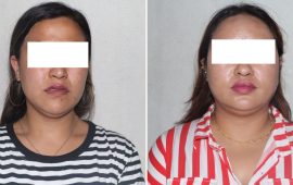 ‘टिकटक गर्ल’को हनी ट्रयापमा सरकारी कर्मचारी, काठमाडौंमा घर-जग्गा बार्गेनिङ