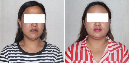 ‘टिकटक गर्ल’को हनी ट्रयापमा सरकारी कर्मचारी, काठमाडौंमा घर-जग्गा बार्गेनिङ