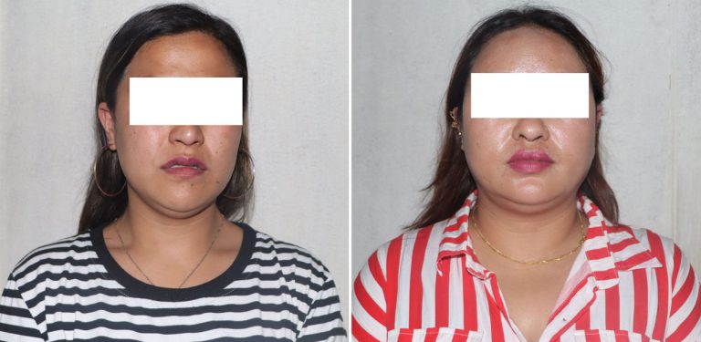 ‘टिकटक गर्ल’को हनी ट्रयापमा सरकारी कर्मचारी, काठमाडौंमा घर-जग्गा बार्गेनिङ