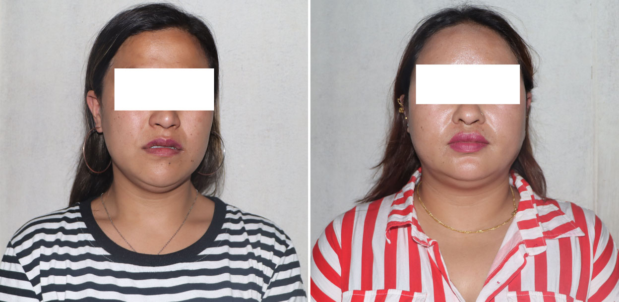 ‘टिकटक गर्ल’को हनी ट्रयापमा सरकारी कर्मचारी, काठमाडौंमा घर-जग्गा बार्गेनिङ