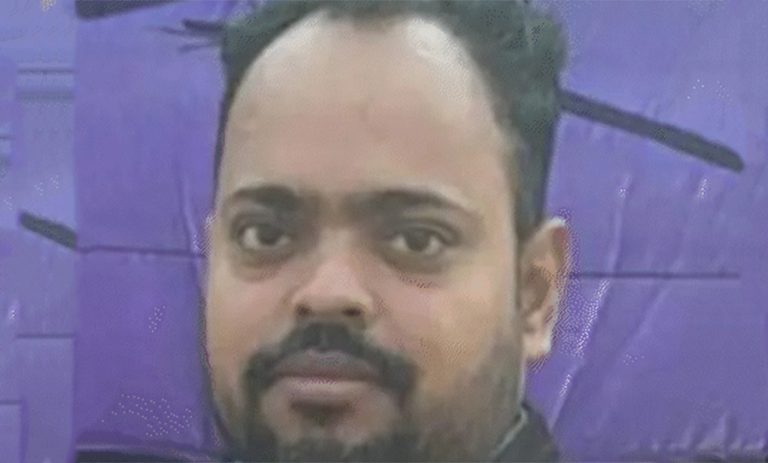 कपाल प्रत्यारोपण गराउन खोज्दा ३७ वर्षीय इन्जिनियरले ज्यानै गुमाए