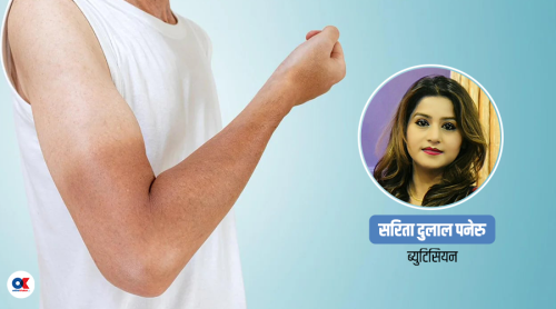चर्को घामका कारण हुने ‘ट्यानिङ’ हटाउने ८ घरेलु उपाय