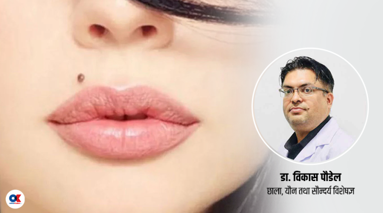 कतिपय कोठी क्यान्सर पनि हुनसक्छ