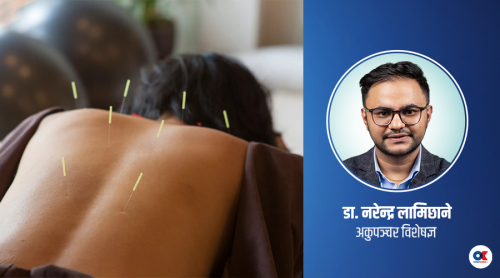 अकुपंचर : प्राचीन सुईको आधुनिक चमत्कार