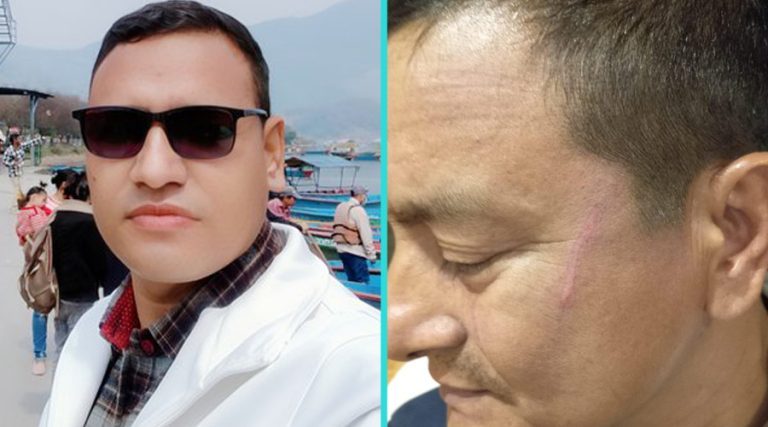 लुम्बिनीको वन मन्त्रालयका अधिकृतद्वारा मापसे गरेर चालकमाथि हातपात