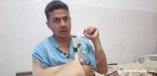 पारदर्शिताको प्रश्न गर्दा वडाध्यक्षबाटै निर्घात कुटियो, हात भाँचियो