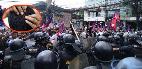 राजावादी प्रदर्शनमा लाठीचार्ज, केही प्रदर्शनकारी घाइते (तस्वीरहरू)