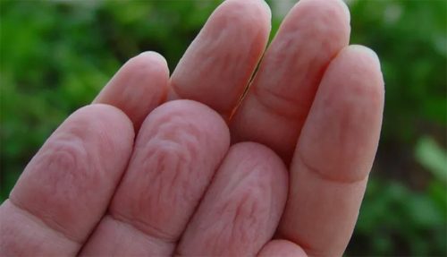 लामो समय पानीमा औँला पर्दा किन चाउरिन्छ ? यसले के संकेत गर्छ ?