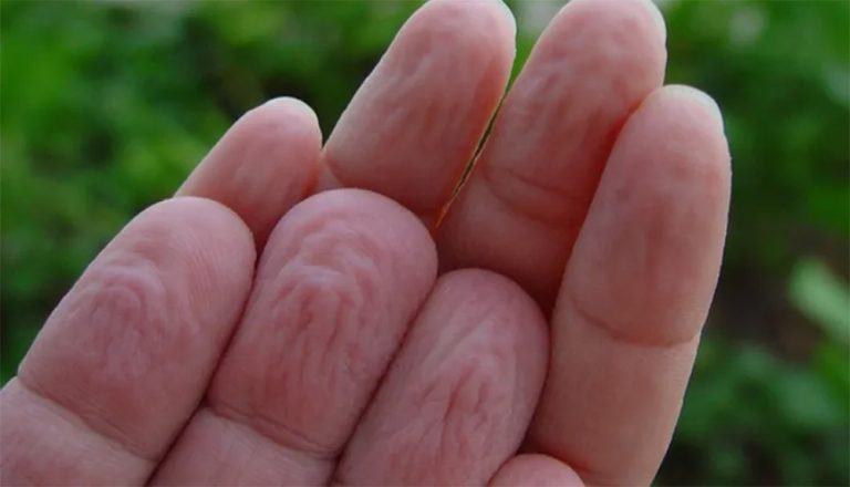 लामो समय पानीमा औँला पर्दा किन चाउरिन्छ ? यसले के संकेत गर्छ ?