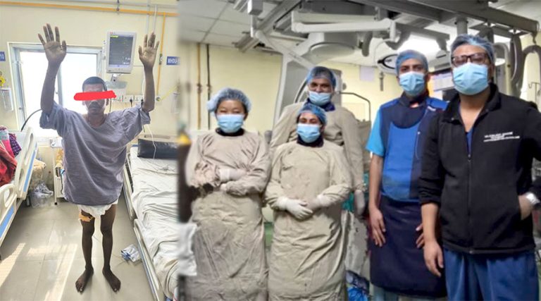 नेपालमै पहिलोपटक घाँटीबाट नसा खोलेर विना सर्जरी मस्तिष्कघातको उपचार