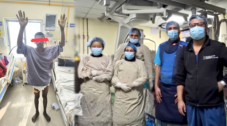 नेपालमै पहिलोपटक घाँटीबाट नशा खोलेर बिनासर्जरी मस्तिष्कघातको उपचार