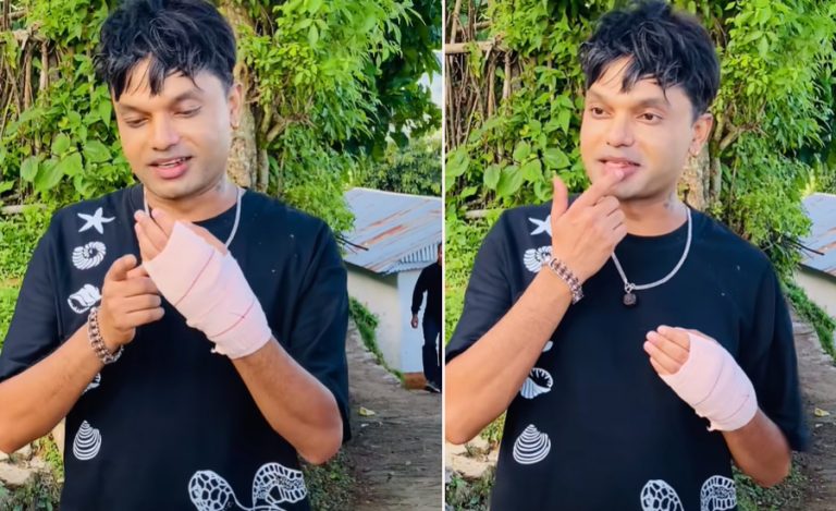 कार दुर्घटनापछि पशुपति शर्मा : ग्रह कट्यो