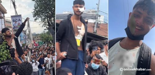 छाती र गालामा गोलीको आलो घाउ बोकेर भाषण गरिरहेका एक युवक