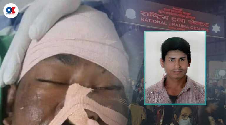 दुई दिनसम्म आईसीयूमा गुमनाम एक युवक- जसको परिवारले घाइते भएको थाहै पाएन