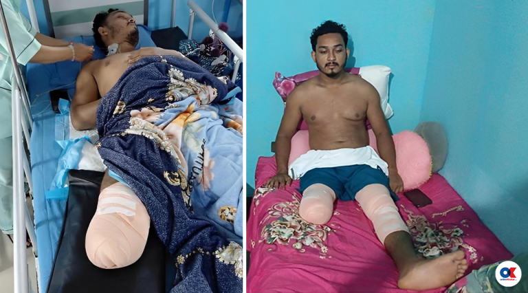 राजेशले सानैमा बुबा गुमाए, आन्दोलनले दाहिने खुट्टा खोस्यो 