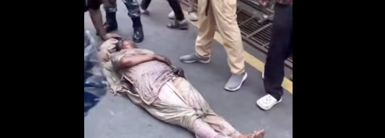 आगजनीमा परी झलनाथ पत्नी घाइते