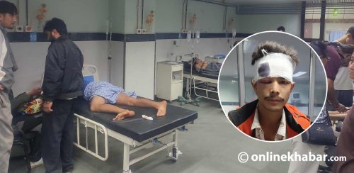 ट्रमा सेन्टरका घाइते भन्छन् : ताकी-ताकी गोली हानियो