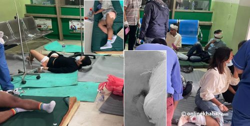 सिभिल अस्पतालको इमर्जेन्सी : मुटु हल्लाउने त्यो दृश्य