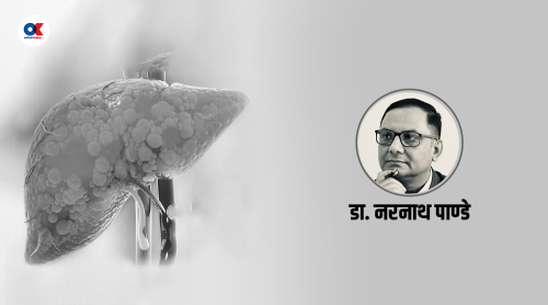 फ्याटी लिभर : कलेजोमा बोसो जम्मा हुने रोग, कसरी बच्ने ?
