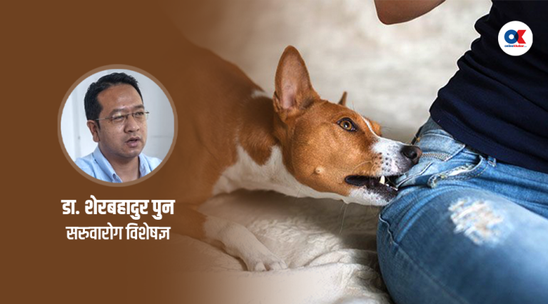 के कुकुरले टोक्दा मात्रै रेबिज सर्छ ?  ९ मिथक र सत्य जानौं