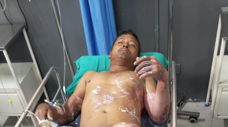 मकवानपुरमा आगलागीबाट २ करोडको क्षति, आगो निभाउने क्रममा घरधनी घाइते