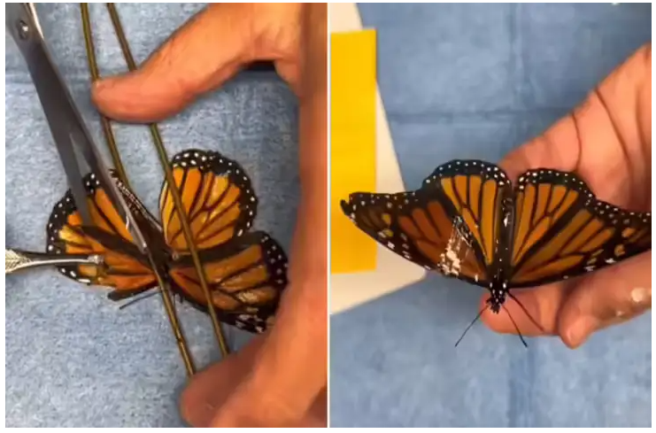 पखेटा प्रत्यारोपणबाट पुतलीले पायो पुनर्जीवन (भिडियो)