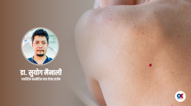 शरीरमा रातो कोठी किन बन्छ ? के छ उपचार ?