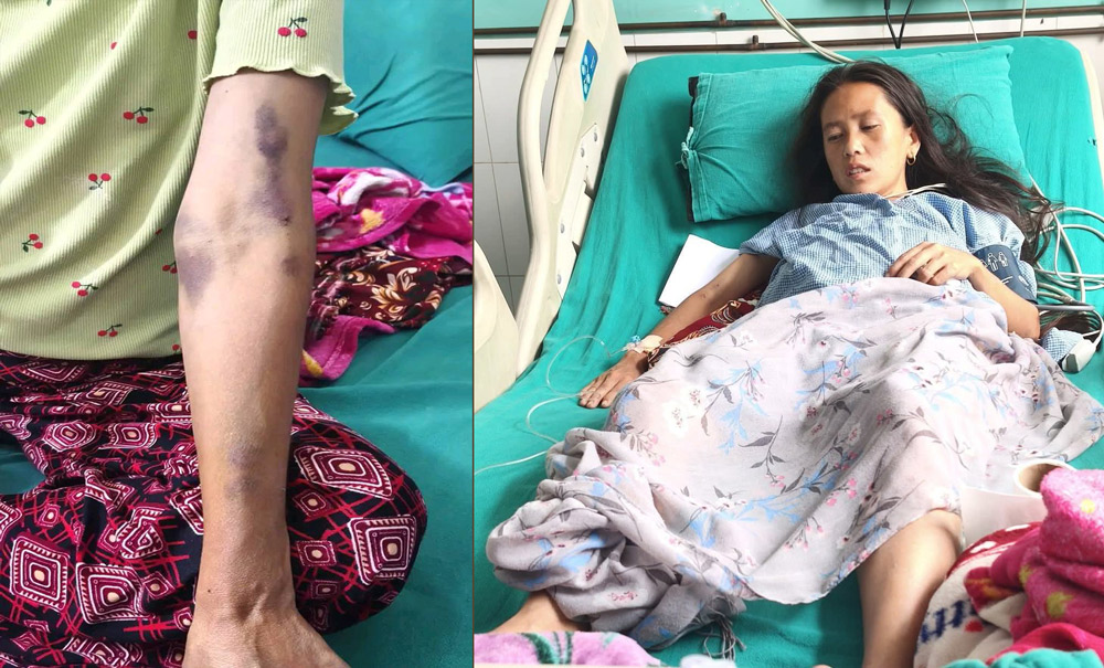 कलेजो प्रत्यारोपण गर्ने खर्च अभाव, सहयोगको याचना गर्दै कमला