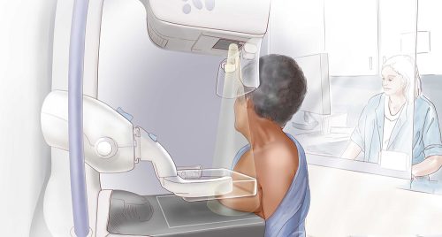 अध्ययन भन्छ– नेपालमा क्यान्सर उपचारका प्रत्येक चरणमा ढिलाइ