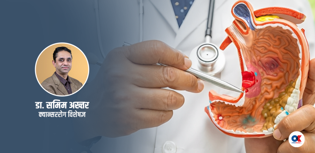 पेटको क्यान्सरको जोखिम पुरुषलाई दोब्बर, कसरी बच्ने ?
