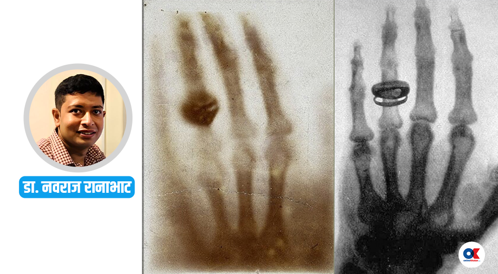 कसरी भएको थियो एक्स-रे प्रविधिको आविष्कार ? दुई प्रसिद्ध तस्बिरको कथा