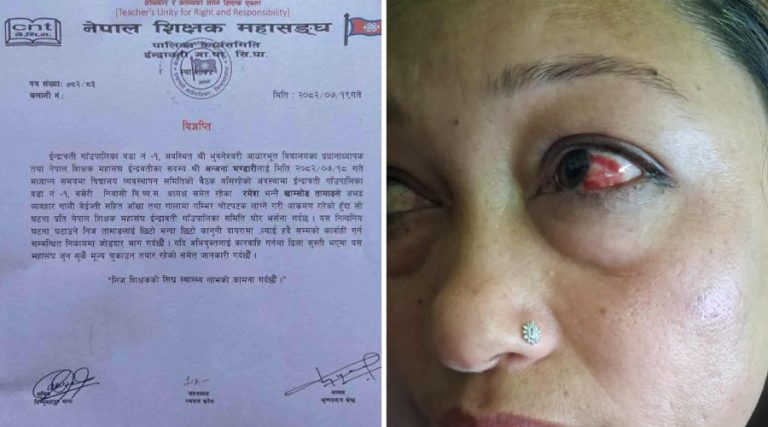 प्रधानाध्यापक भण्डारीलाई व्यवस्थापन समिति अध्यक्षले कुटे, आँखामा चोट
