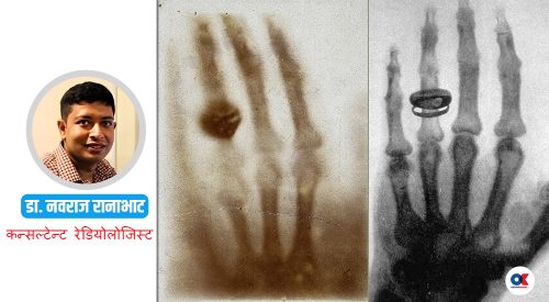 कसरी भएको थियो एक्स-रे प्रविधिको आविष्कार ? दुई प्रसिद्ध तस्बिरको कथा