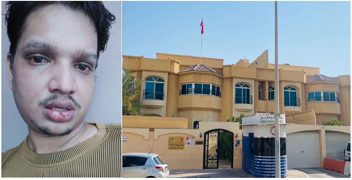 डेढ वर्षदेखि यूएईको यात्रा प्रतिबन्धमा अर्घाखाँचीका घिमिरे