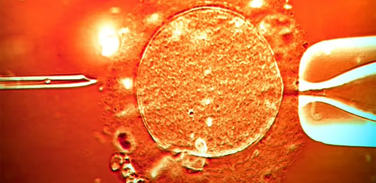 एकजना वीर्यदातामा क्यान्सरयुक्त जिन भेटिएपछि युरोपमा तरंग !