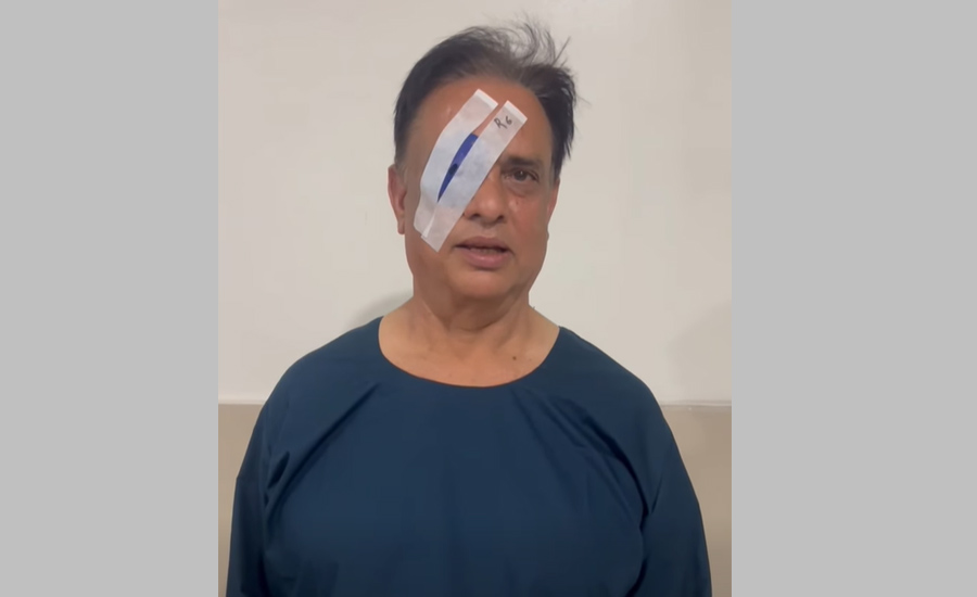 हरिवंशले गराए मोतिबिन्दुको शल्यक्रिया