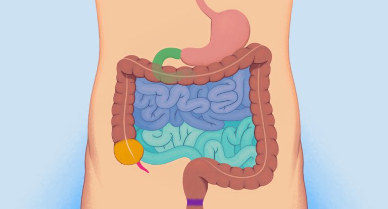 हाम्रो आन्द्रा सफा र स्वस्थ राख्न के-के गर्ने ?