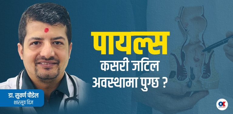 पायल्स चट्टै निको बनाउन सकिन्छ ? डाक्टरलाई  ६ प्रश्न