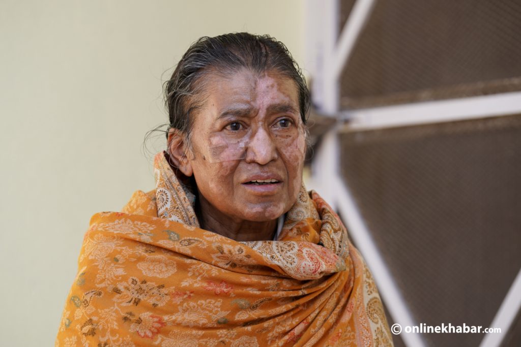 ‘सासै फेर्न नसकेर ढलें, होसमा आउँदा देब्रे हात काटिएको रहेछ’