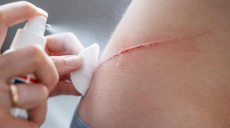 युद्ध मैदान र आपतकालीन उपचारमा क्रान्ति, बन्यो १ सेकेन्डमै रगत रोक्ने स्प्रे 