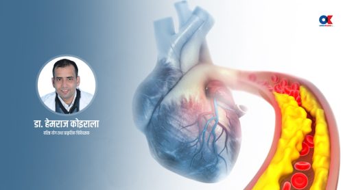 कोलेस्टेरोल घटाउने प्राकृतिक तरिकाबारे जानौं