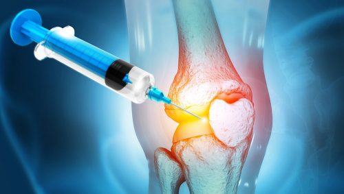 नयाँ अध्ययनको निष्कर्ष : खिइएको हड्डी पुन: फर्काउन सम्भव छ