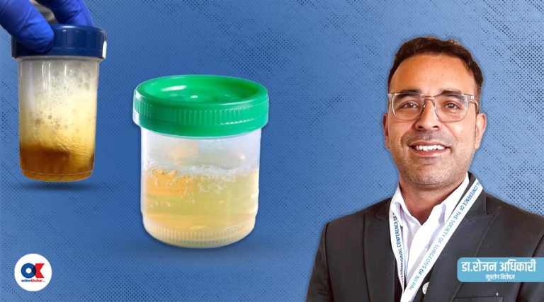 के पिसाबमा फिँज देखिनु कुनै रोगको संकेत हो ?