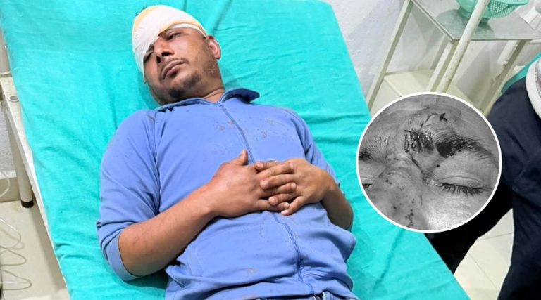 बैतडीमा एमाले–रास्वपा कार्यकर्ताबीच झडप, एमालेका दुई कार्यकर्ता घाइते