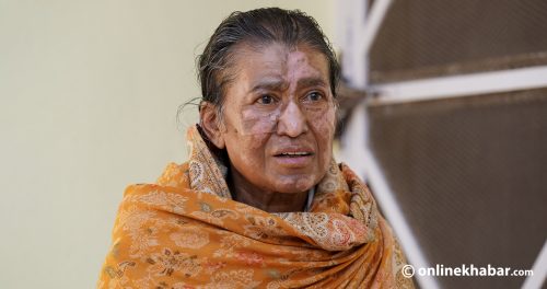 शरीर जल्यो, मन जलेन : रविलक्ष्मीको त्यो सहनशीलता