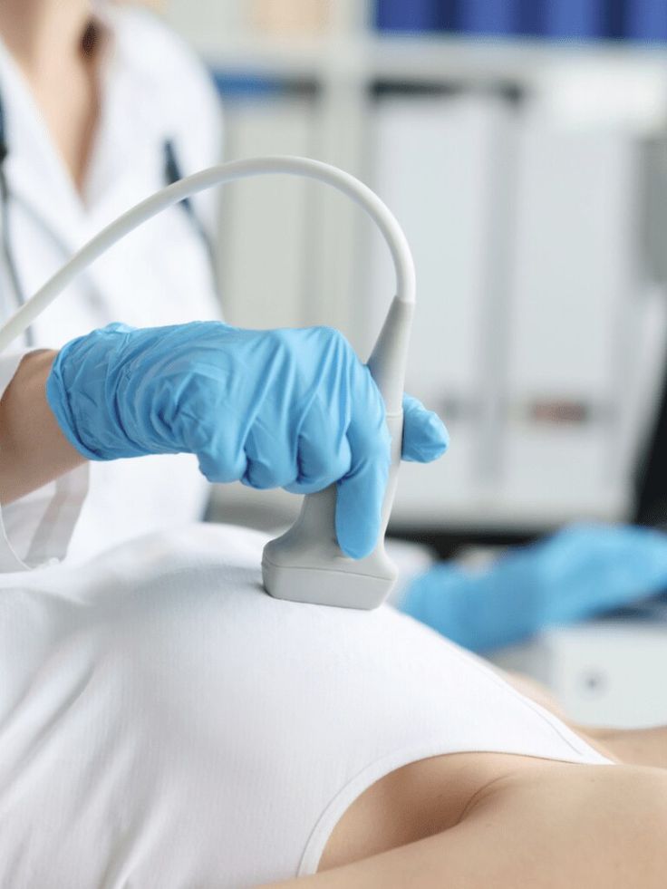 ५ गल्ति, जसले स्तन क्यान्सरको जोखिम गराउनसक्छ