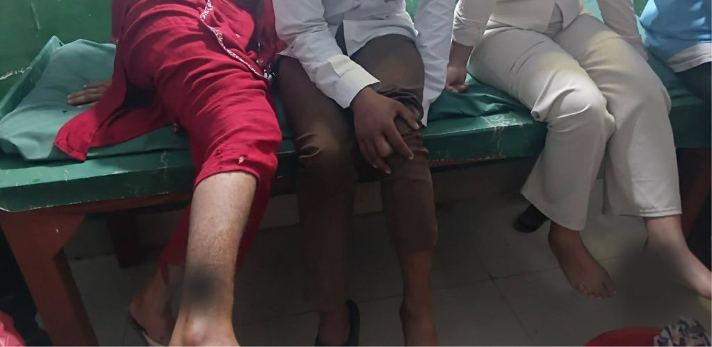 कञ्चनपुरमा कुकुरको टोकाइबाट १६ जना घाइते