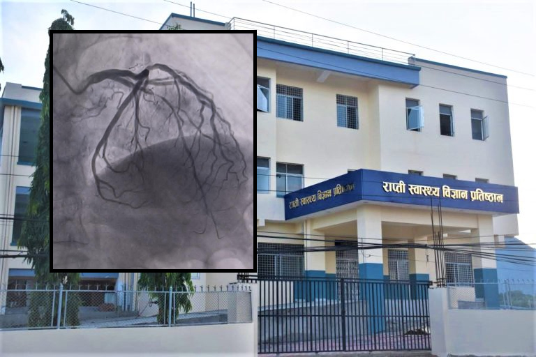 राप्ती स्वास्थ्य विज्ञान प्रतिष्ठानमा मुटु रोगको उपचार पनि सुरु