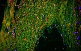 मस्तिष्कभित्र फोहोर निष्कासन गर्ने मार्ग भेटियो, अल्जाइमरको उपचारमा नयाँ क्रान्तिको संकेत