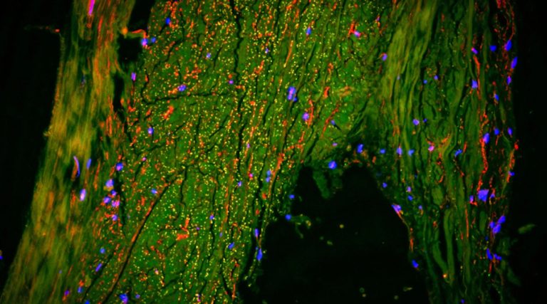 मस्तिष्कभित्र फोहोर निष्कासन गर्ने मार्ग भेटियो, अल्जाइमरको उपचारमा नयाँ क्रान्तिको संकेत
